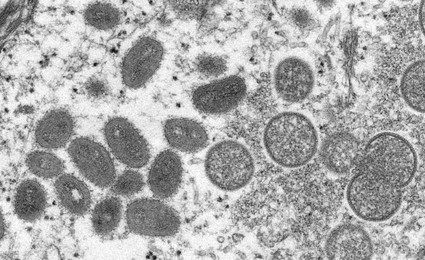 Vietnam yet to record monkeypox cases